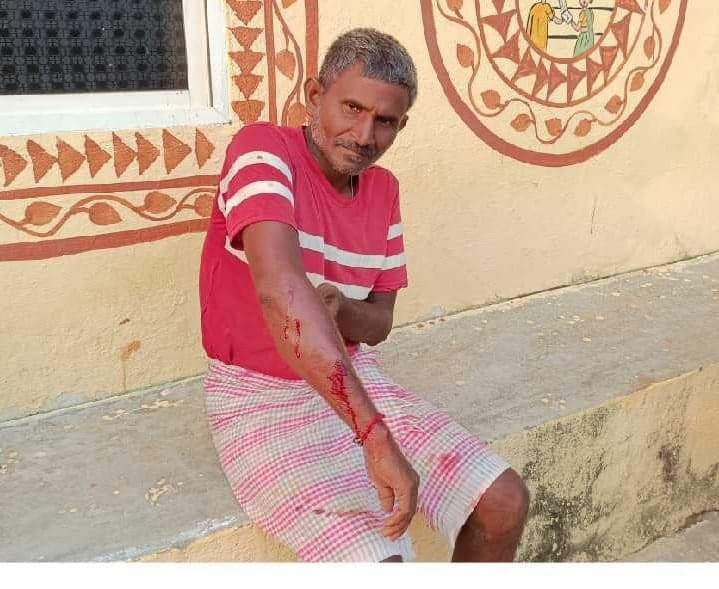 వేమనపల్లిలో రైతుపై అడవి పంది దాడి - Udayam