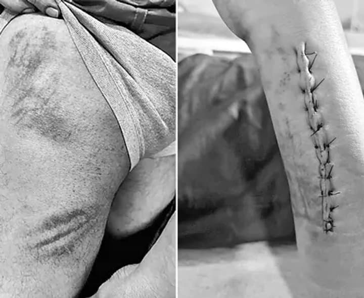 సురేఖ మాజీ ఓఎస్డీపై హత్యాయత్నం కేసు