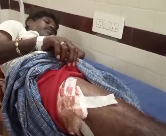 మేకల కాపరిపై ఎలుగుబంటి దాడి