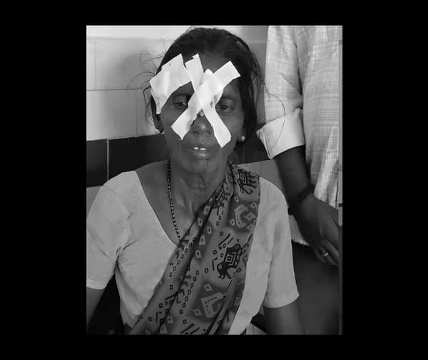 పిచ్చికుక్కల దాడి: ఆరుగురికి తీవ్ర గాయాలు - Udayam Digital