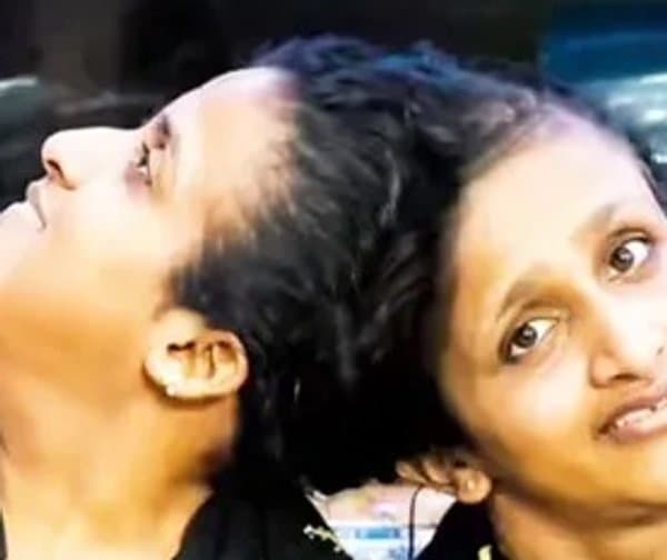 సబా, ఫరా కవలల నరకయాతన