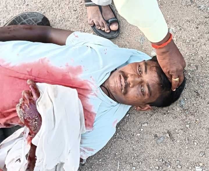 చికిత్స పొందుతూ యువకుడి మృతి - Udayam
