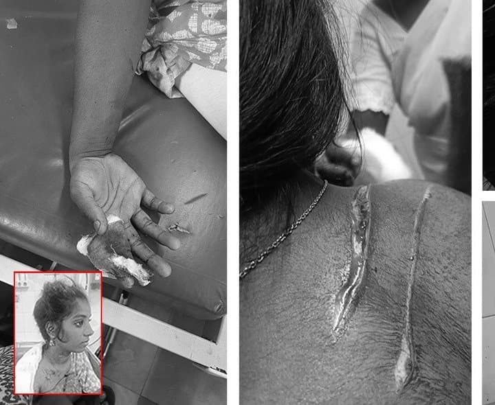 మైనర్ బాలికపై బ్లేడ్ బ్యాచ్ దాడి