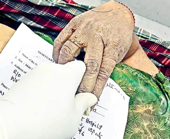 మృతదేహంపై బంగారం మాయం