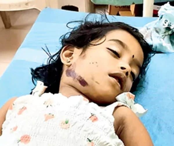 మొక్కు తీర్చుకునే లోపే ఘోర ప్రమాదం - Udayam Digital