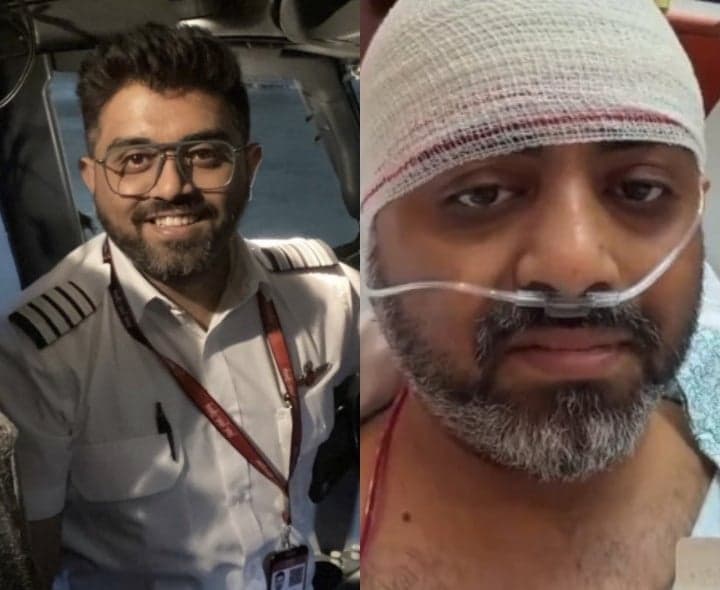 పైలట్ స్మిత్ తలకు ఫ్రాక్చర్.. UAEలో చికిత్స