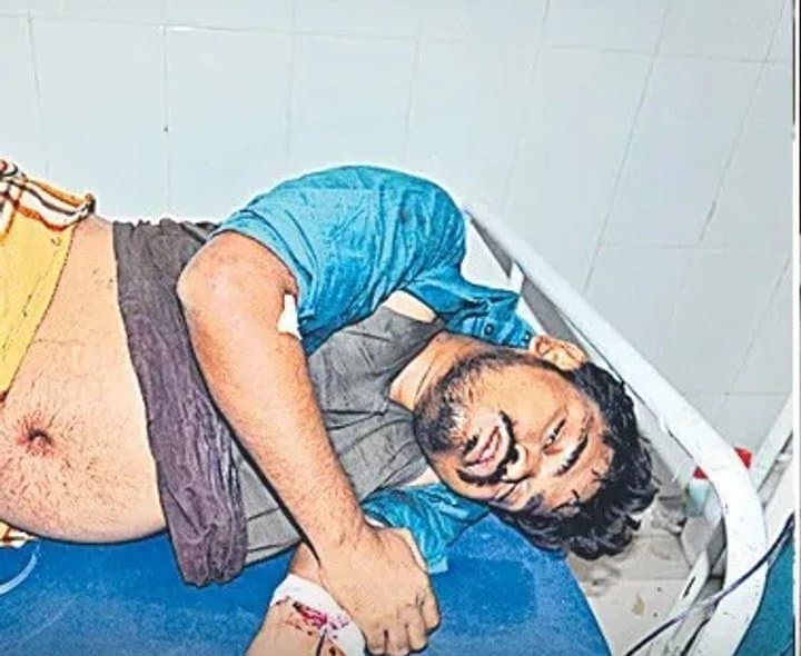 కూతురిపై కన్నేసి గాయపడ్డాడు