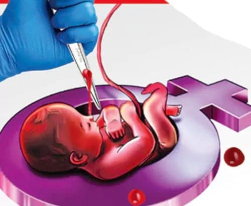 బాల్యవివాహాలు తగ్గినా.. పెరిగిన సిజేరియన్లు