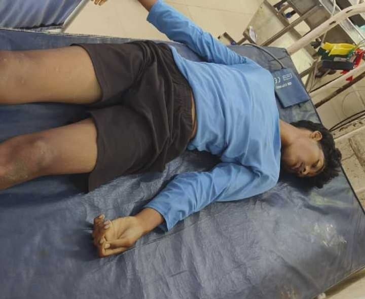 బుచ్చయ్యపేట:  ప్రాణం తీసిన నాటు వైద్యం