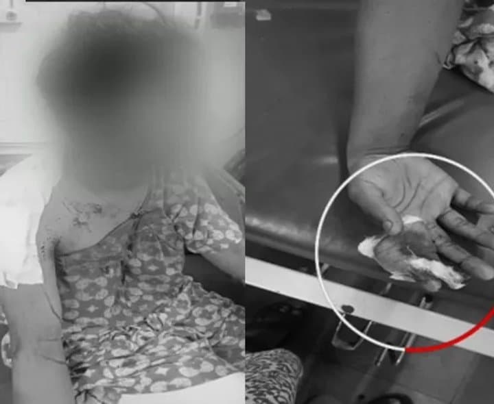 తిరుపతి: బాలికపై బ్లేడ్‌ దాడి