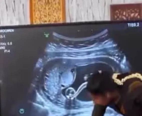 చిన్నారులకు జంక్‌ఫుడ్‌ భయం!