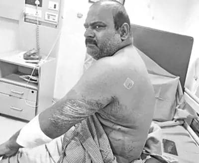 కారుతో దంపతులను ఢీకొట్టిన డ్రైవర్