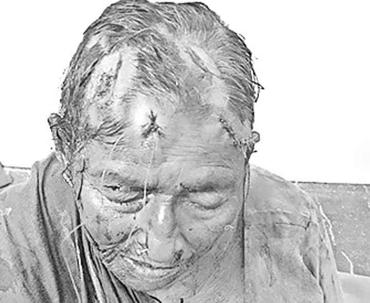 ఆస్తికోసం పెంచిన తల్లిపై దాడి