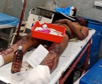 కాటేదాన్‌లో కెమికల్ బ్లాస్ట్‌.. ఇద్దరికి గాయాలు
