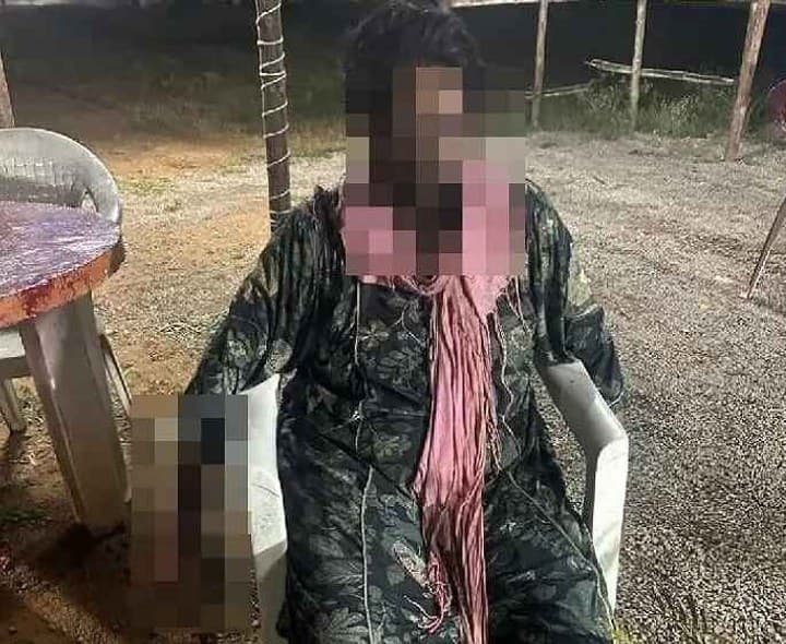 మహిళపై యాసిడ్ దాడి