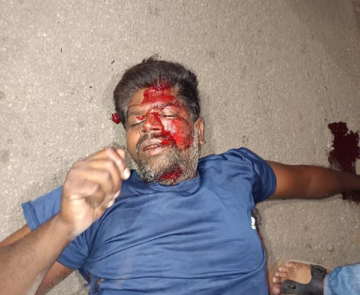 షాద్ నగర్ ఎలికట్ట చౌరస్తా దగ్గర రోడ్డు ప్రమాదం ఇద్దరికీ గాయాలు - Udayam