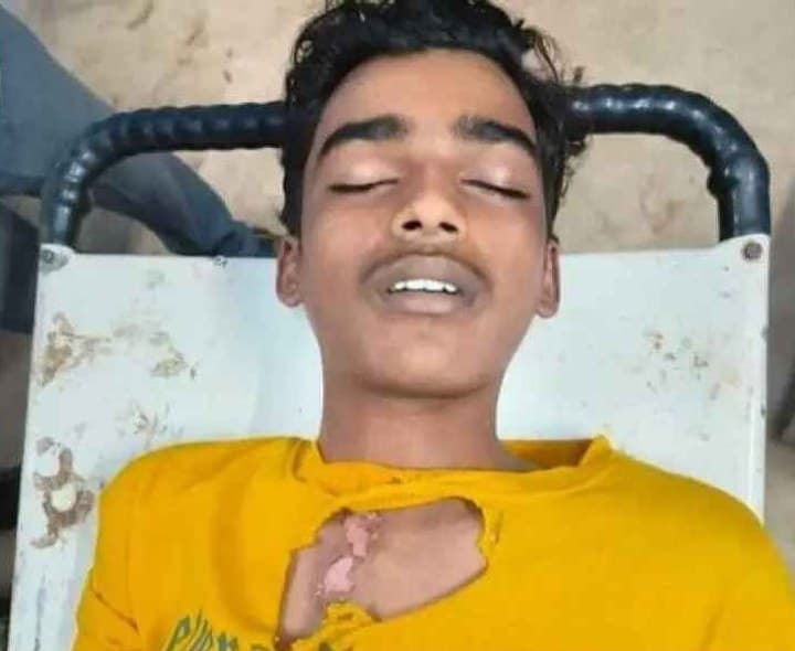 నిజామాబాద్ పిడుగుపాటుకు 18 ఏళ్ల యువకుడి మృతి - Udayam