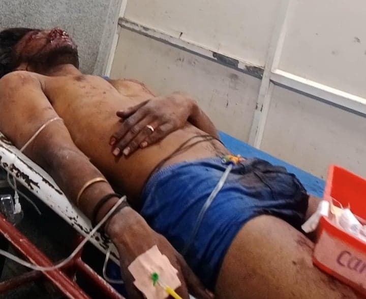 కాటేదాన్లో కెమికల్ బ్లాస్ట్.. ఇద్దరికి గాయాలు - gallery image 2