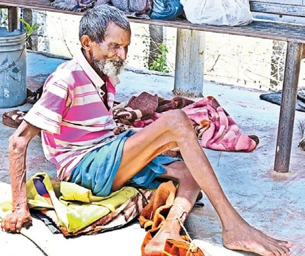 ఆశ్రయం లేని వృద్ధుడి దుర్భర జీవితం - Udayam Digital