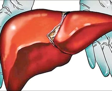 తండ్రి కోసం 20 కిలోలు తగ్గిన కుమారుడు - Udayam