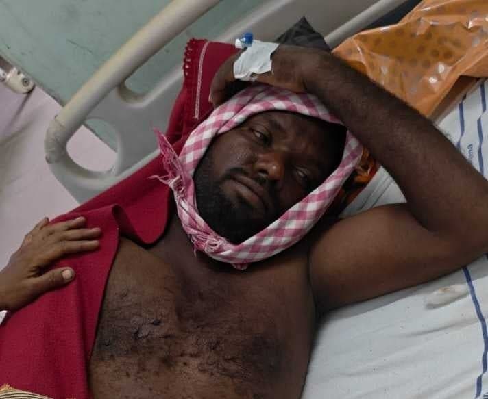 పిడుగుపాటుతో రైతుకు తీవ్ర గాయాలు - Udayam