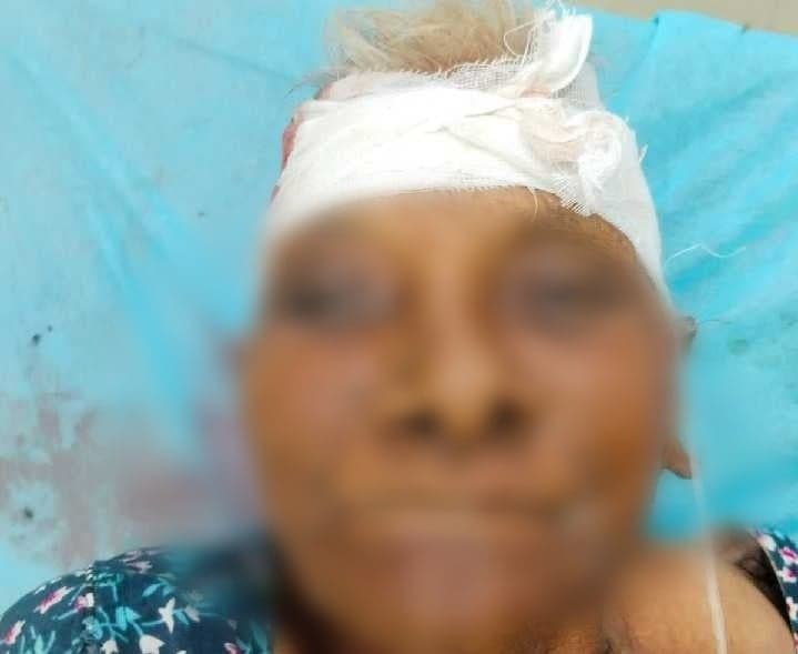 చిలకలూరిపేటలో వృద్ధురాలికి తీవ్ర గాయాలు - Udayam