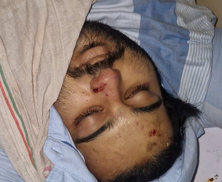 అతీక్ అహ్మద్ చిన్న కుమారుడు రోడ్డు ప్రమాదంలో మృతి - Udayam Digital