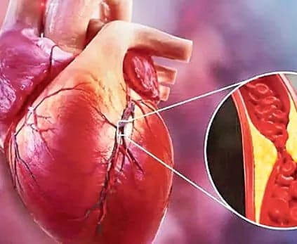 సెరోట్రాన్స్ఫరిన్తో ముప్పు - Udayam