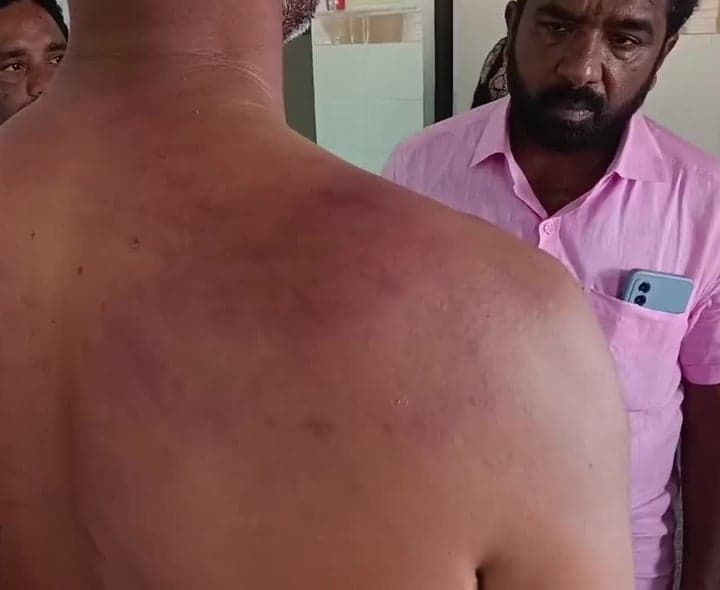 దాడి ఆరోపణలు.. సర్పంచ్పై కేసు - Udayam