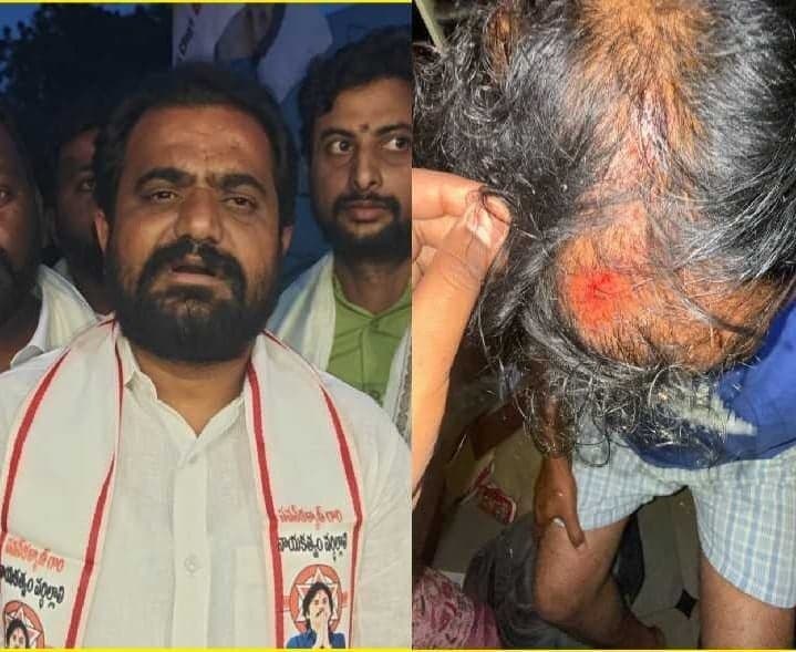 రోడ్డు ప్రమాదంలో జనసేన నేతకు గాయాలు - Udayam