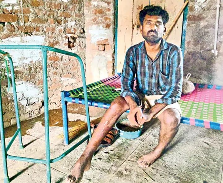 అజయ్ చూపు కోల్పోయి, నడవలేని స్థితిలో - Udayam