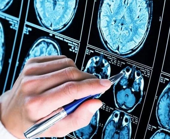 అల్జీమర్స్ నిర్ధారణపై నిపుణుల స్పష్టత - Udayam