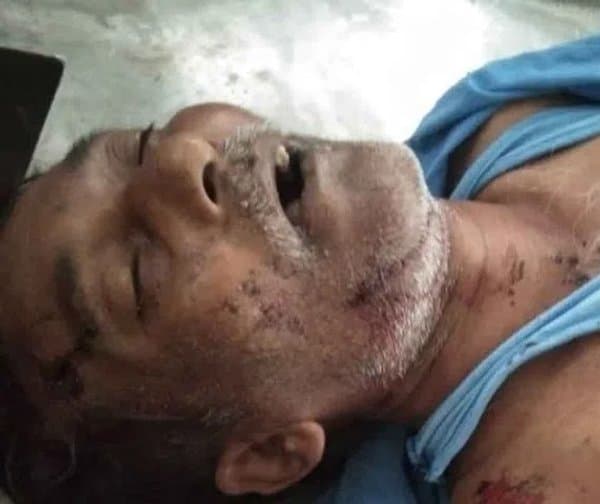 టిప్పర్ రూపంలో మృత్యువు: కార్మికుడి దుర్మరణం - Udayam Digital