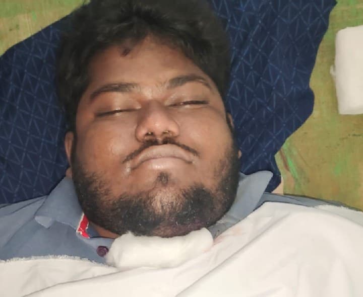 మెట్లపై నుంచి జారిపడి యువకుడు మృతి కుటుంబంలో విషాదం - Udayam