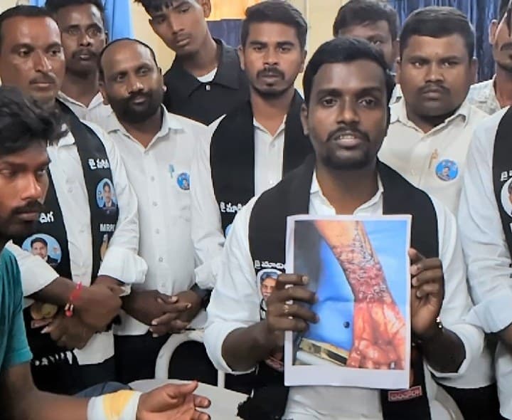 గంగసారం గ్రామంలో మాదిగలపై దాడి - Udayam