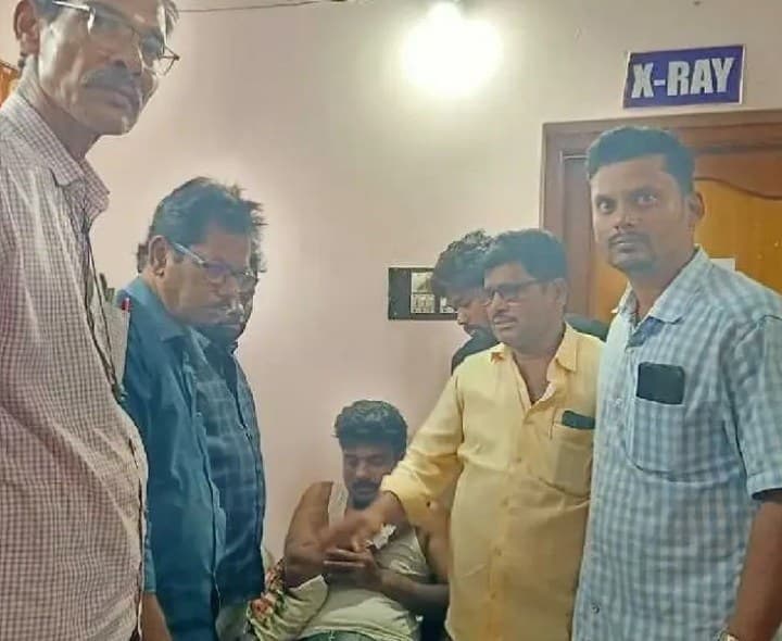 విద్యుత్ స్తంభం పైనుంచి జారిపడిన లైన్మెన్ - Udayam