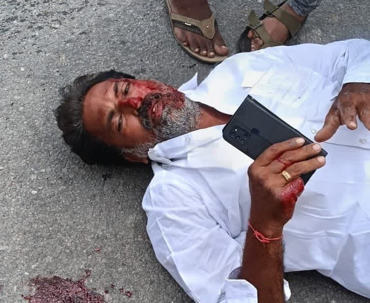 రోడ్డు ప్రమాదాన్ని గురైన రైతు నాయకుడు - Udayam