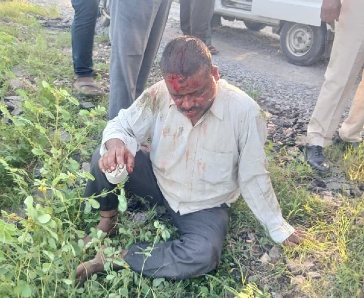 బైక్ అదుపుతప్పి కిందపడి వ్యక్తికి తీవ్రగాయాలు - Udayam