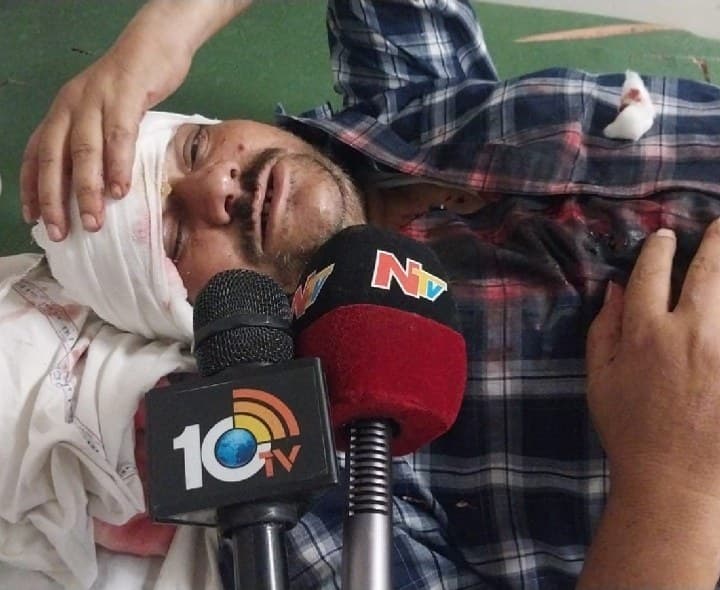 కొండగట్టు వద్ద ఆర్టీసీ బస్సు–లారీ ఢీ - Udayam